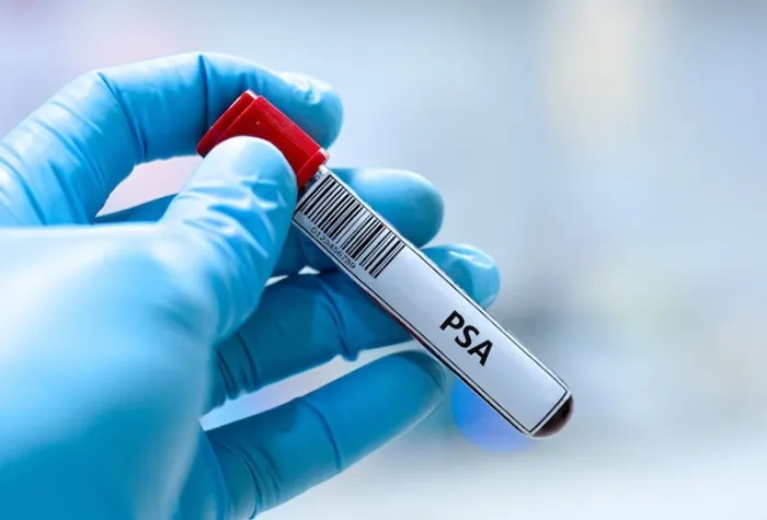 psa test